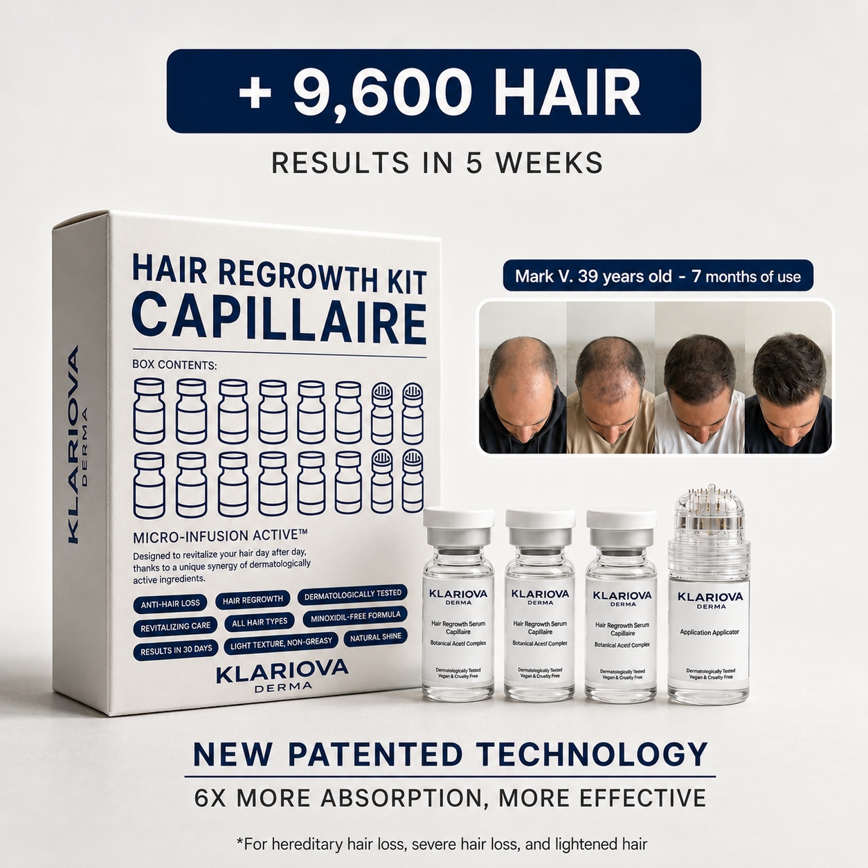 KLARIOVA™ HAIR LOSS TREATMENT & REGROWTH