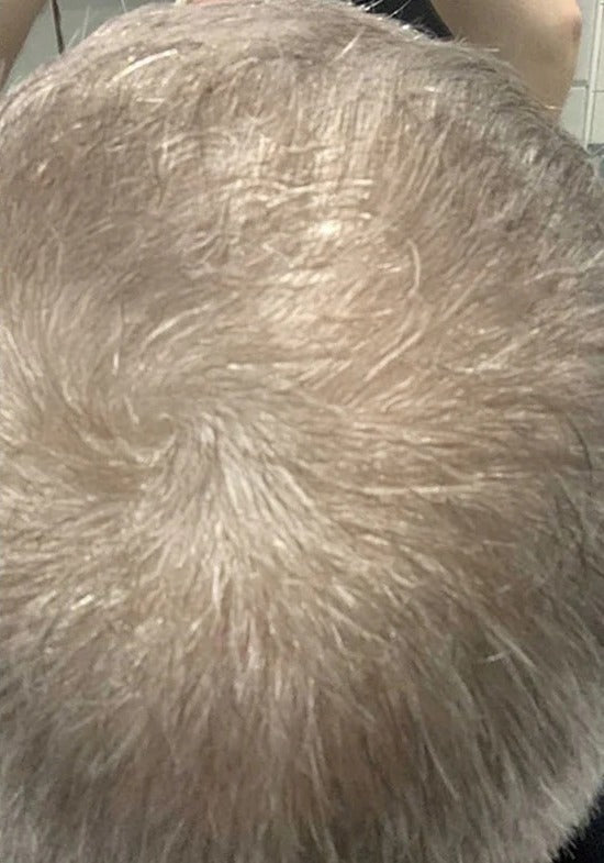 After
