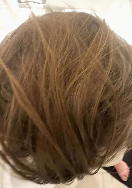 After